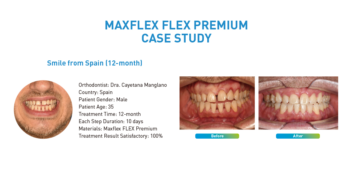 MAXFLEX FLEX PREMIUM CASE STUDY