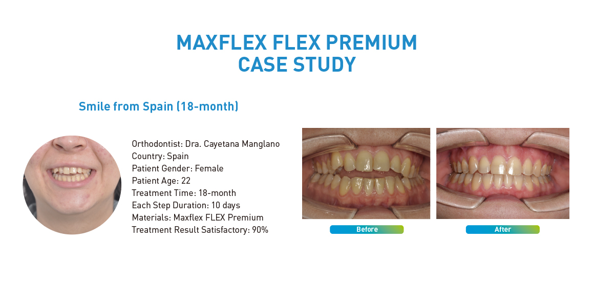 MAXFLEX FLEX PREMIUM CASE STUDY