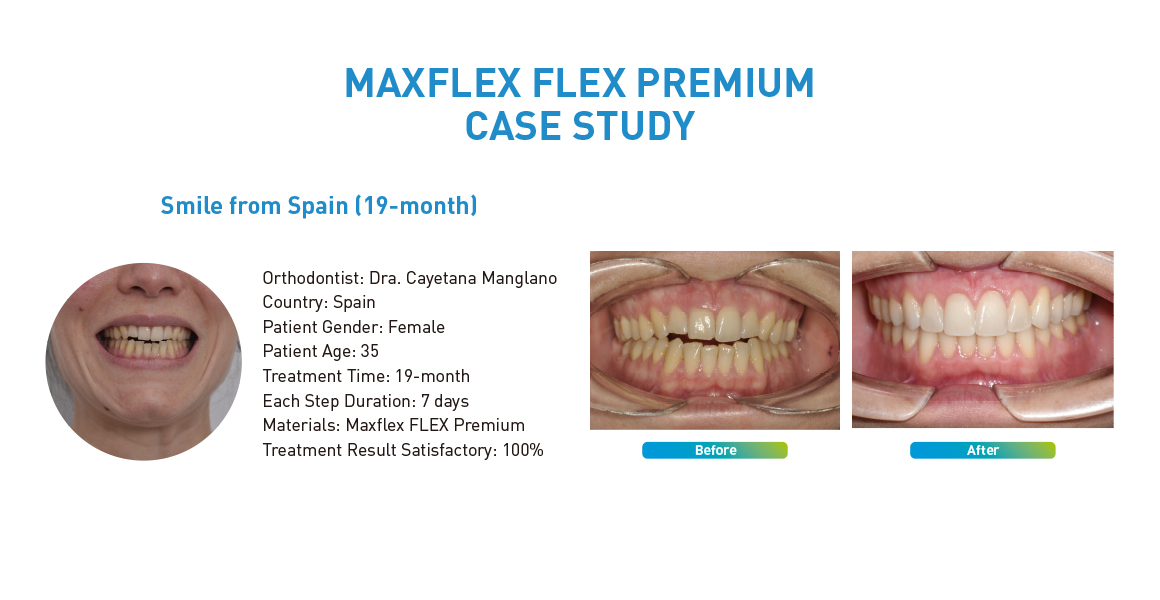 MAXFLEX FLEX PREMIUM CASE STUDY