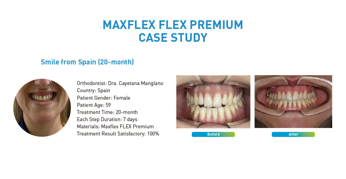 MAXFLEX FLEX PREMIUM CASE STUDY