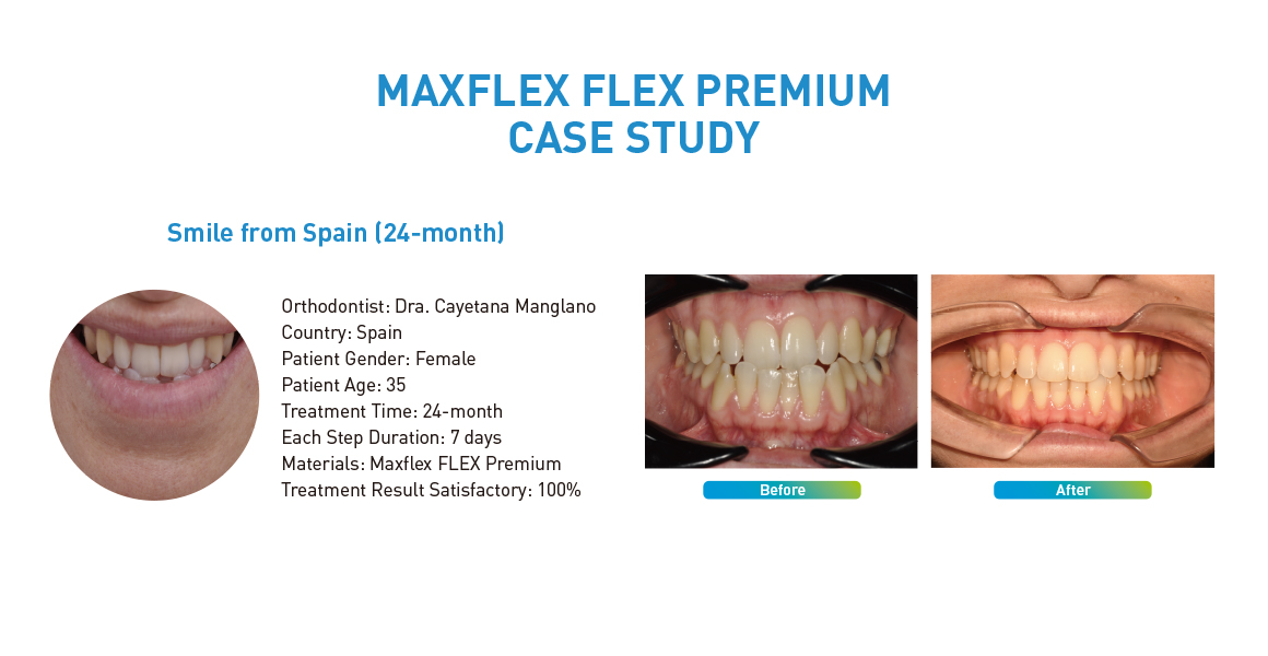 MAXFLEX FLEX PREMIUM CASE STUDY
