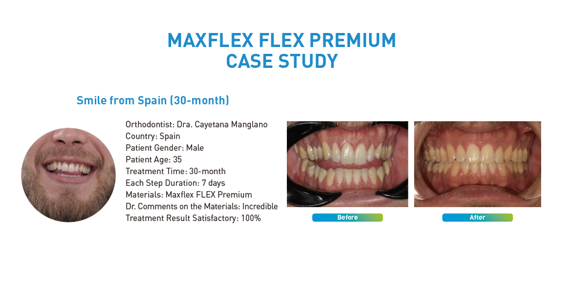 MAXFLEX FLEX PREMIUM CASE STUDY