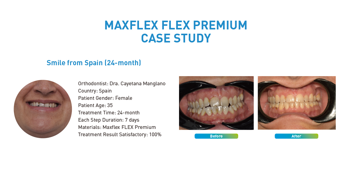 MAXFLEX FLEX PREMIUM CASE STUDY