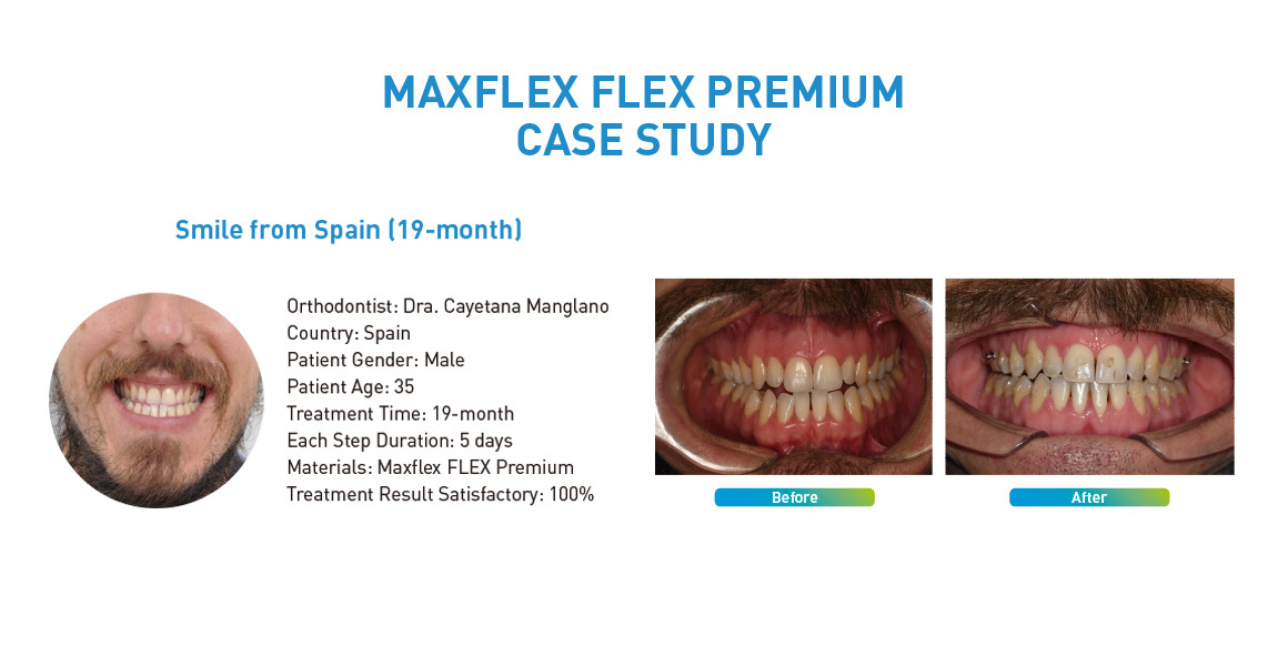MAXFLEX FLEX PREMIUM CASE STUDY