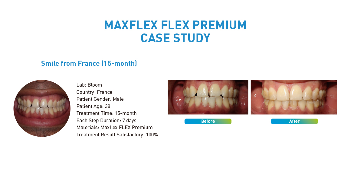 MAXFLEX FLEX PREMIUM CASE STUDY