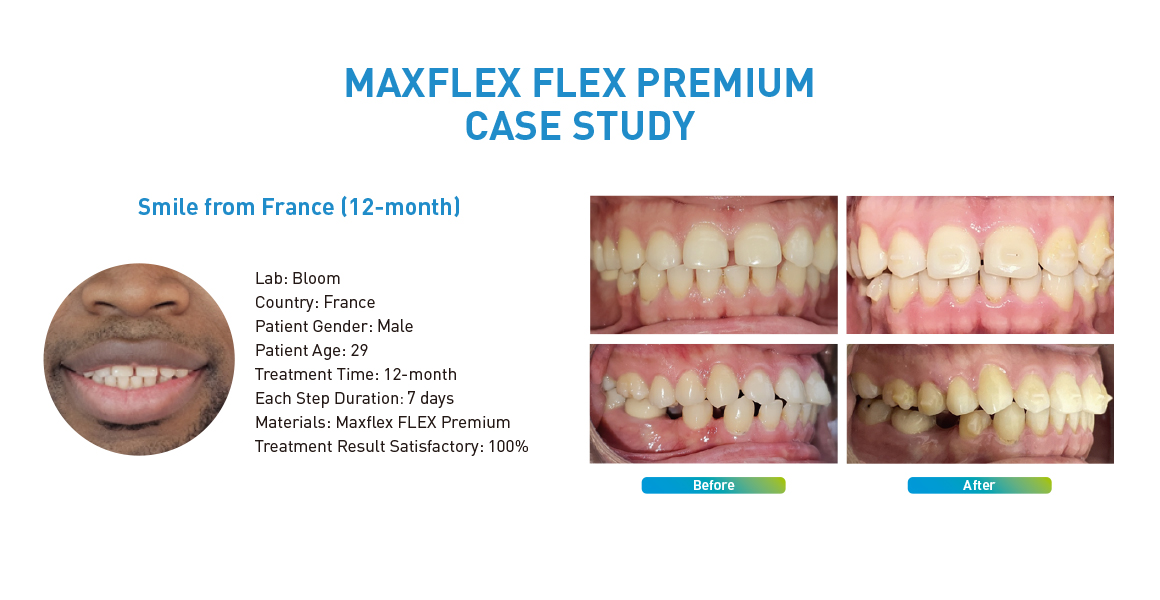 MAXFLEX FLEX PREMIUM CASE STUDY