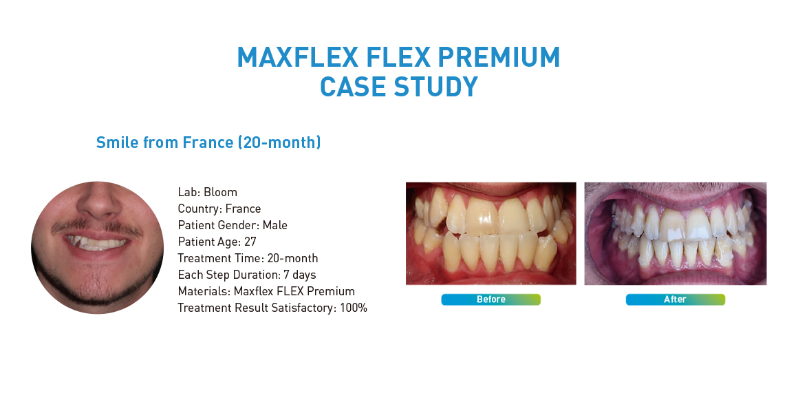 MAXFLEX FLEX PREMIUM CASE STUDY