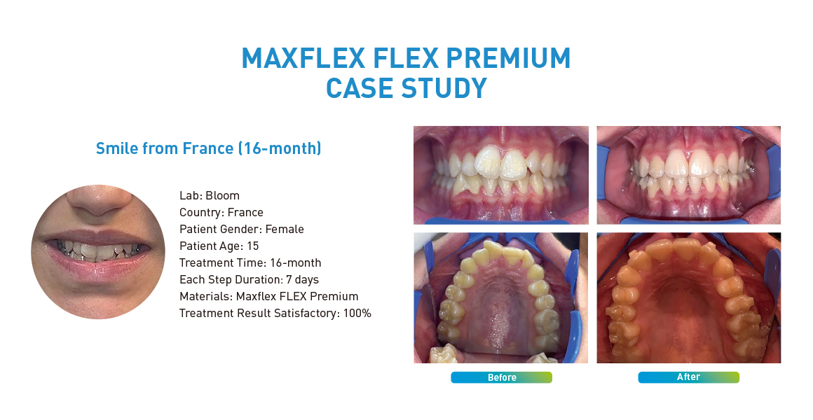 MAXFLEX FLEX PREMIUM CASE STUDY