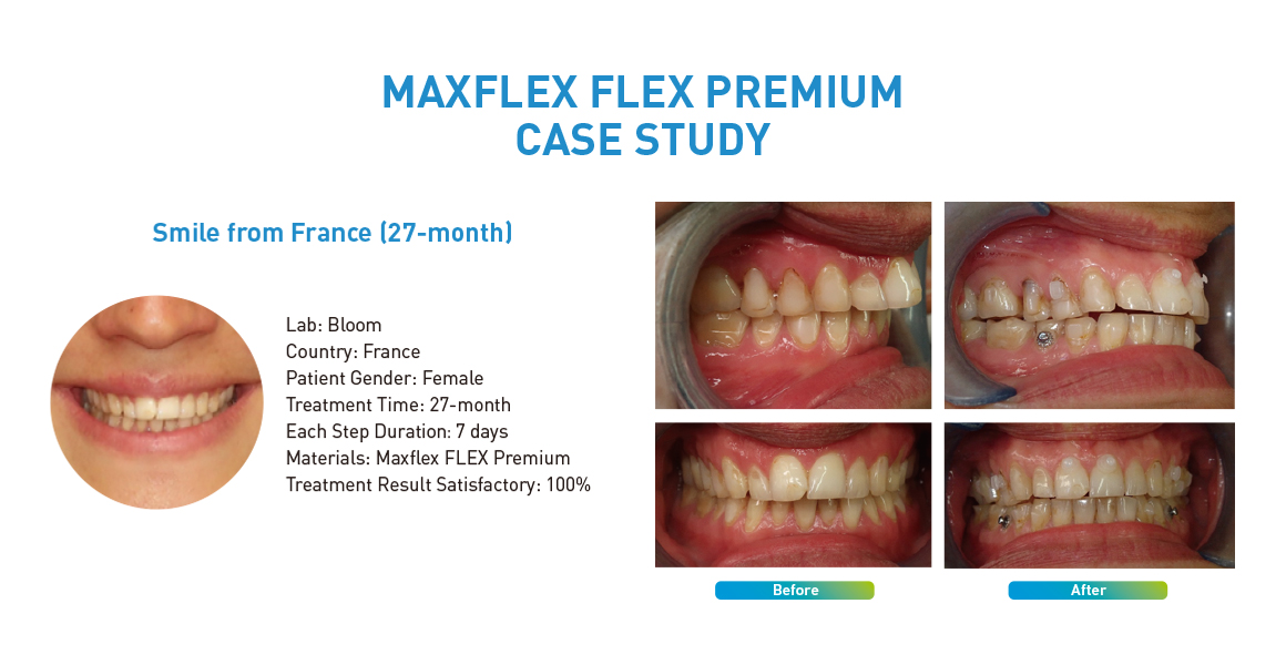 MAXFLEX FLEX PREMIUM CASE STUDY
