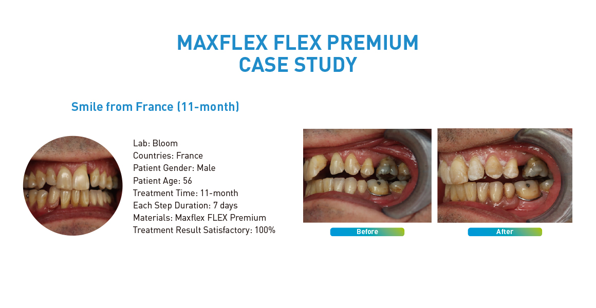 MAXFLEX FLEX PREMIUM CASE STUDY