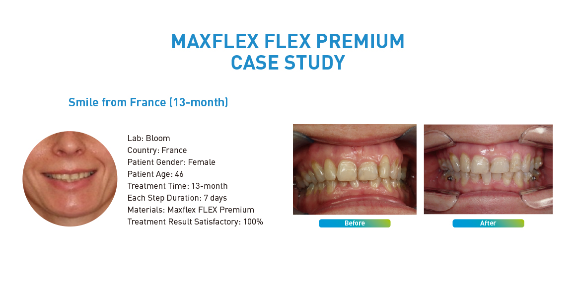 MAXFLEX FLEX PREMIUM CASE STUDY